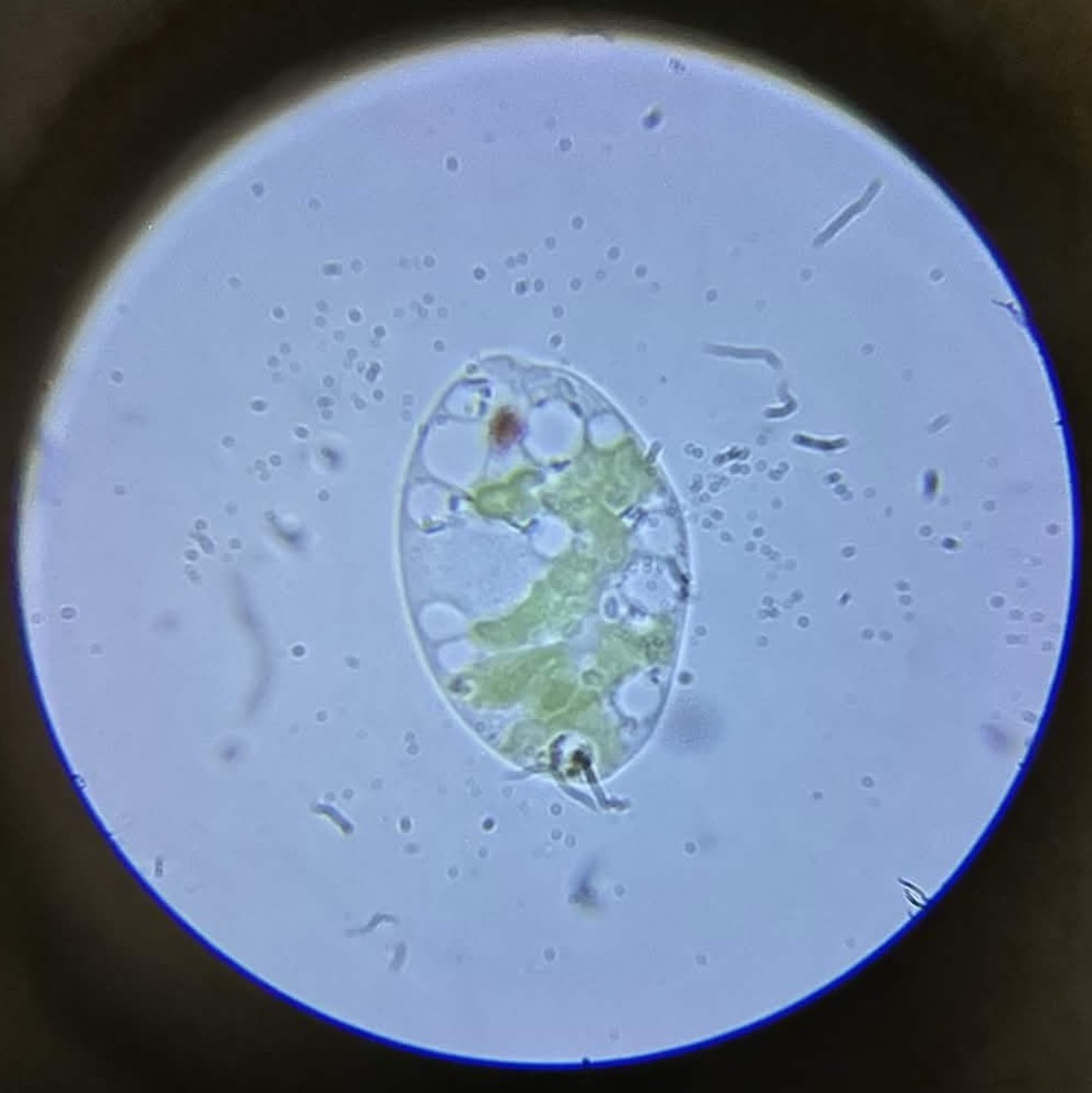 A dead protozoa