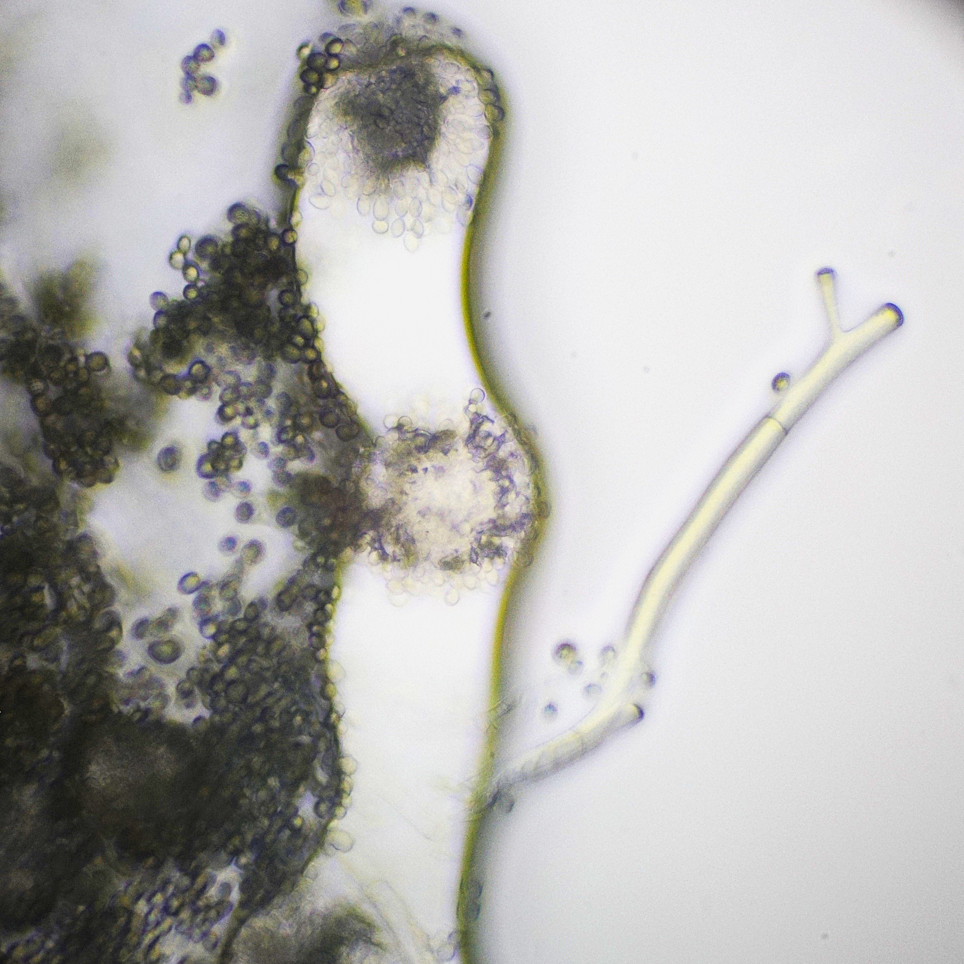 Cluster of spores and fungi of green mold