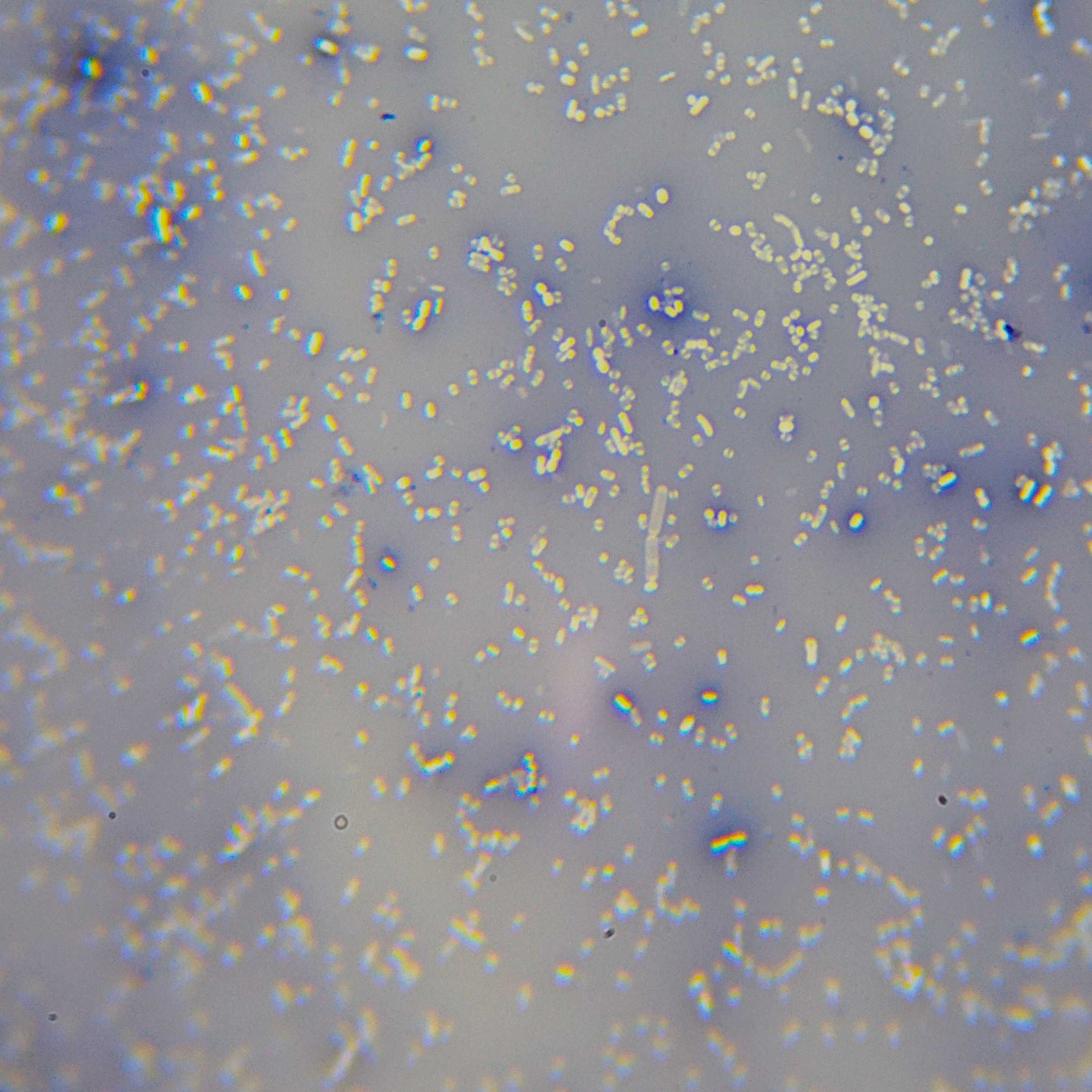 Cluster of spores and fungi of lots of bacteria