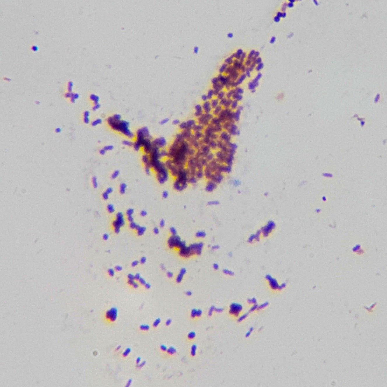 Gram stain of various bacteria