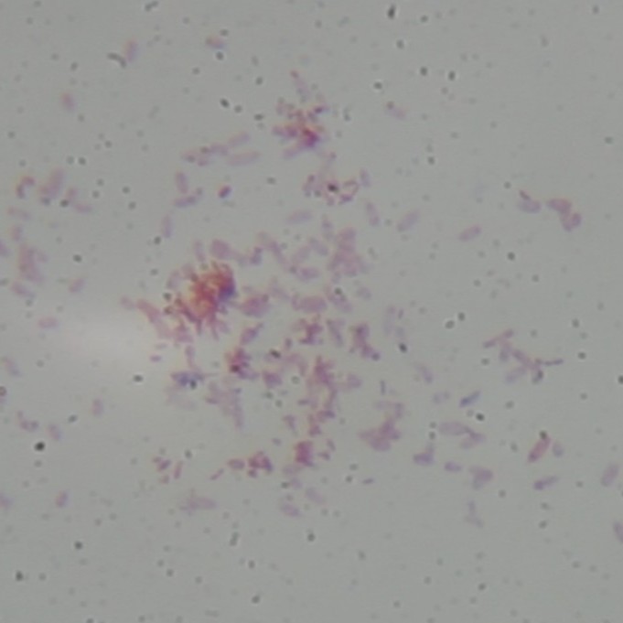 Gram-Negative stain